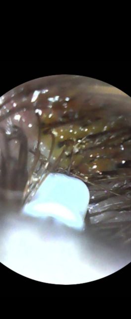 미용실 염색 후 염증 발생에 대한 처리여부의 0번 째 이미지