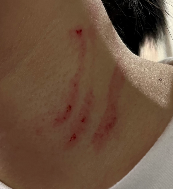 신체적 정신적인 상해를 입었는데 합의금 어떻게 해야할까요의 0번 째 이미지