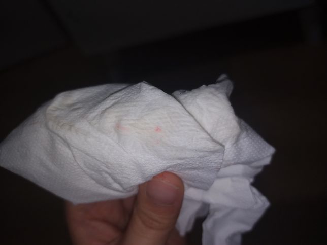 겐타마이신 크림이 원래 주황색 분홍색 뭔가가 나오나요?의 1번 째 이미지