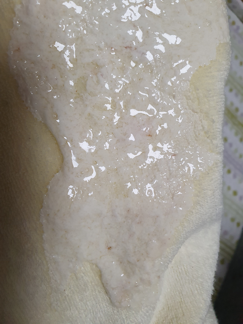 5개월 아기 토에서 분유에 갈색같은게 섞여 나왔는데 뭐일까요의 0번 째 이미지