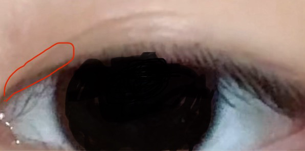 오늘 아침부터 눈이 간지럽고 따끔거려요의 1번 째 이미지