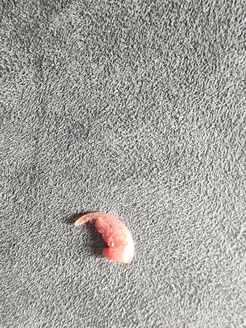 저희집 강아지가 발을 깨물다가 발톱이 빠졌습니다의 0번 째 이미지