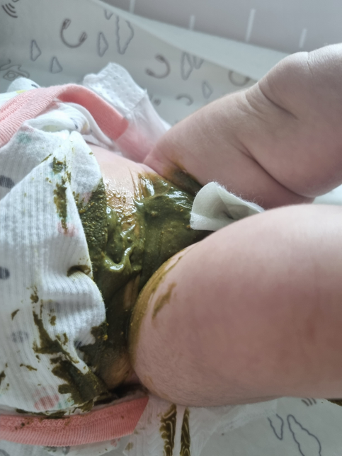 똥이 초록색에 설사가 심해요 왜이러는걸까요?의 0번 째 이미지