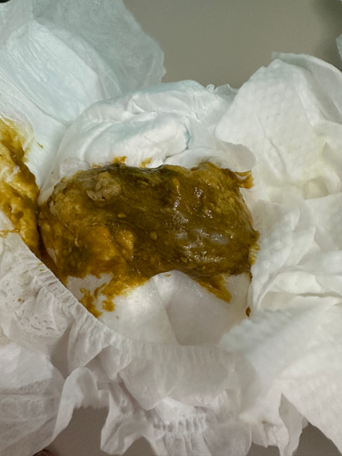 4개월 아기 변상태 괜찮은가요?의 0번 째 이미지