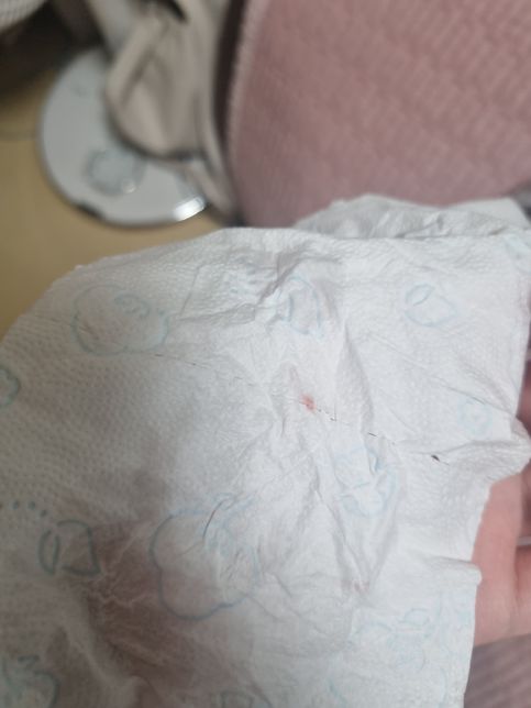 이거 착상혈인가요?(사진있어요 봐주세요)의 0번 째 이미지