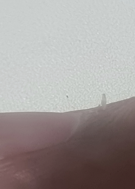 손톱 주위에 거스러미가 자주 생기는데 예방할 방법이 있을까요?의 0번 째 이미지