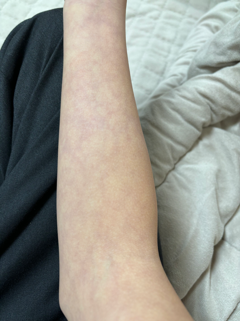 피부에 이상하게 생겼습니다 이거 뭔가요의 0번 째 이미지