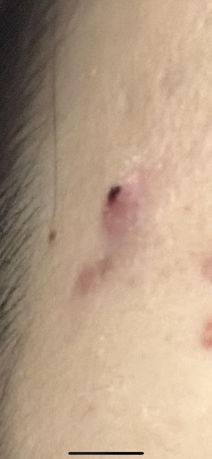 이런게 자주 나는데 어떻게 해야할까요?의 0번 째 이미지