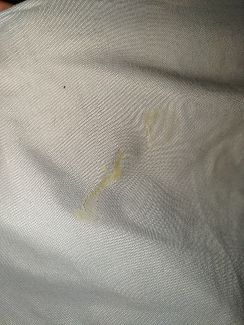 텐트에 묻은 본드자국을 어떻게 지워야할까요?의 0번 째 이미지