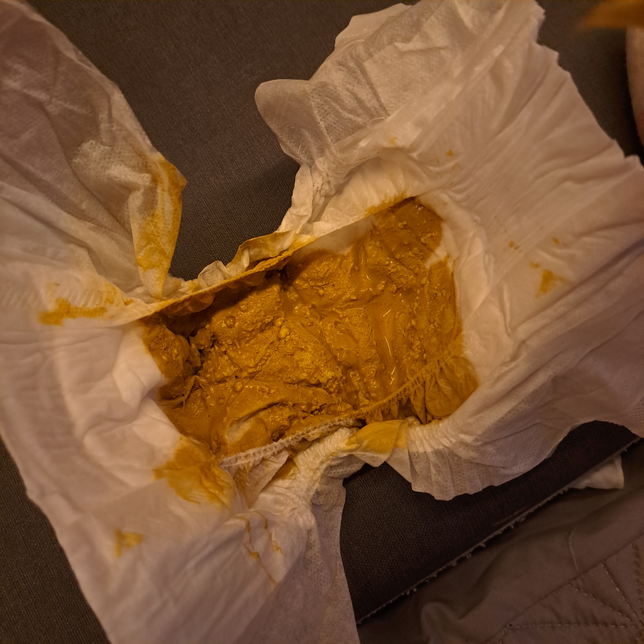 30일 안 된 아기 대변 정상인가요? 사진 주의의 3번 째 이미지