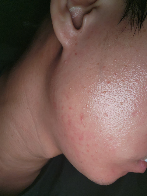 에스로반 휴지기 얼마나 가지면 되나요?의 0번 째 이미지