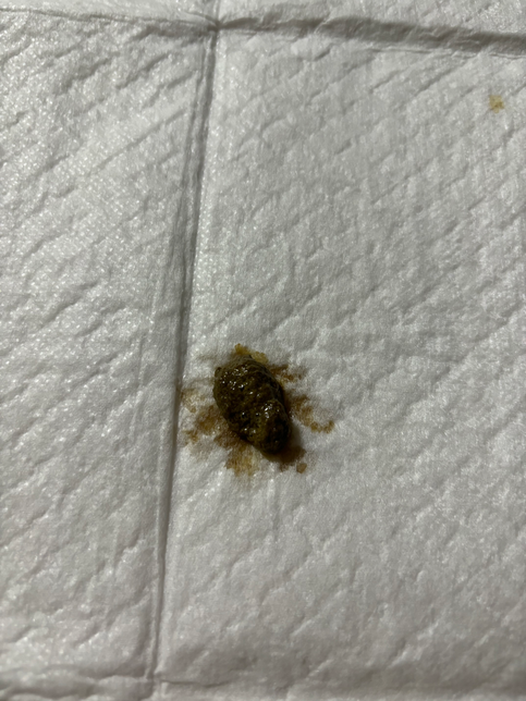 강아지 똥 상태 괜찮은거 맞나요??의 0번 째 이미지