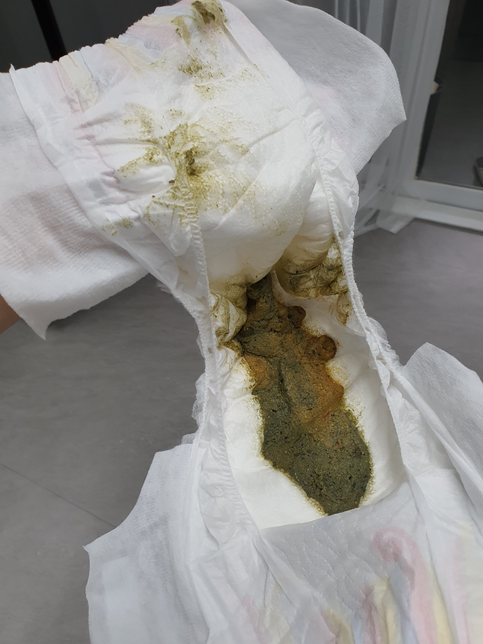 블루베리과자를먹어도 변색깔이 바뀌나요? (사진주의)의 1번 째 이미지