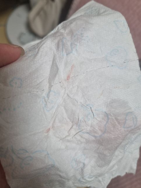 이거 착상혈인가요?(사진있어요 봐주세요)의 1번 째 이미지