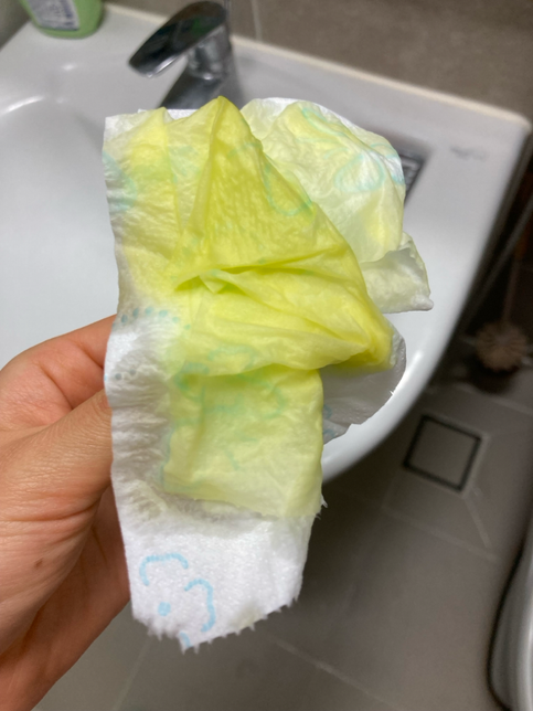 강아지 소변 색상이 조금 이상한 거 같아요!의 1번 째 이미지