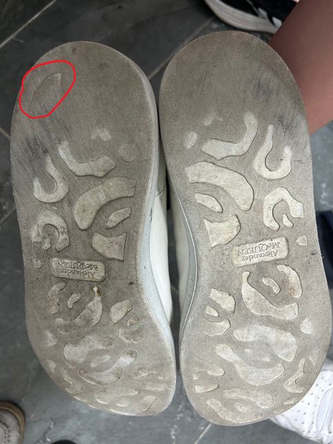 중고거래중 하자 미기재 이거 환불 해드려야되나요의 1번 째 이미지