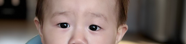 9개월 아기 눈 안검하수 일까요?의 1번 째 이미지