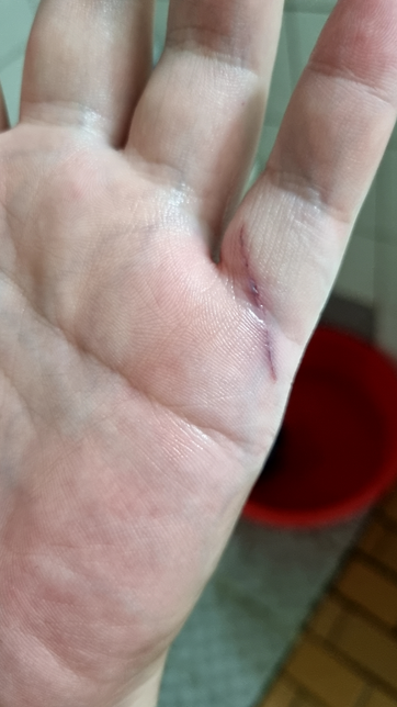 상처났는데 마데카솔 바르면 낫나요의 0번 째 이미지