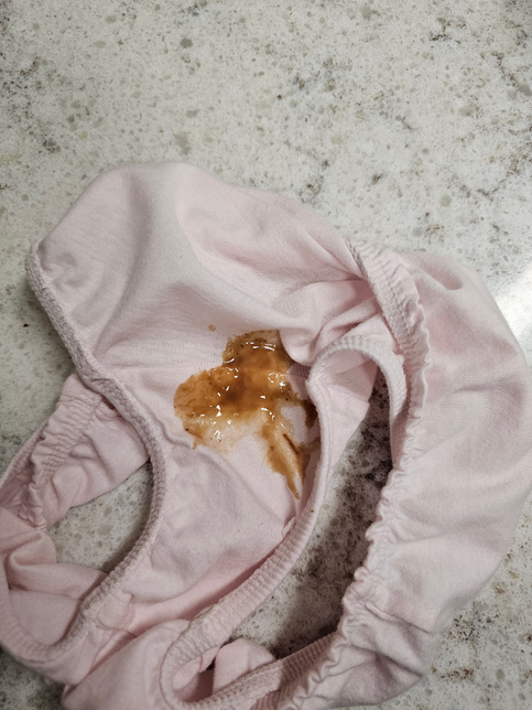 6세 여아 끈적끈적 비린내나는 물똥 사진 첨부?의 0번 째 이미지