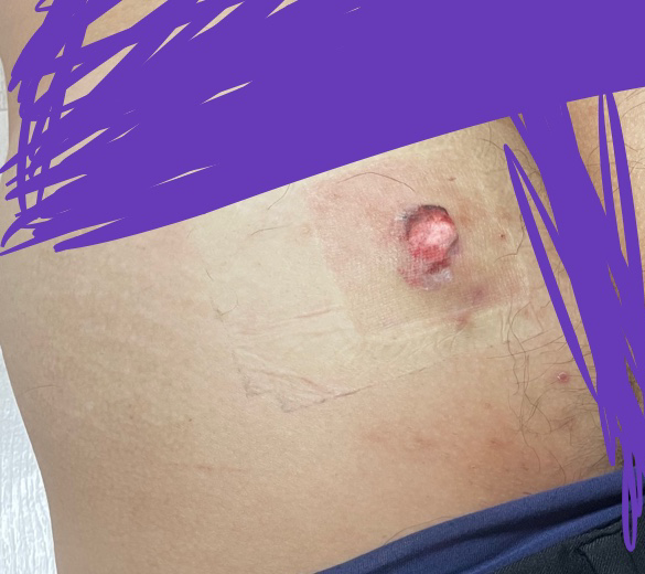 피부과 진료받았는데 심각합니다의 0번 째 이미지