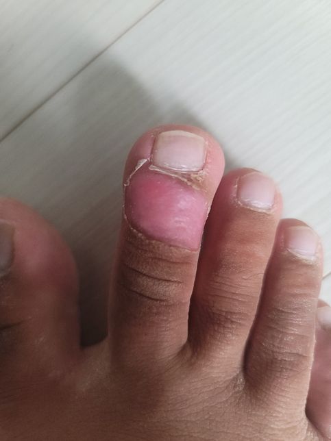 피부 재생크림이 지금 상태에 효과가 있을까요?의 0번 째 이미지