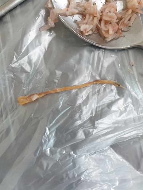 새우젓을 샀는데 안에 이런게 있는데 무엇인지..의 0번 째 이미지