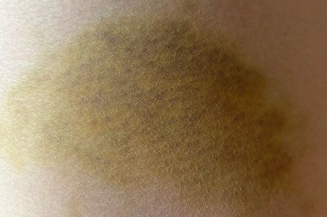 친오빠의 폭력, 신고와 처벌 가능한가요의 1번 째 이미지