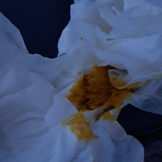 30일 안 된 아기 대변 정상인가요? 사진 주의의 2번 째 이미지