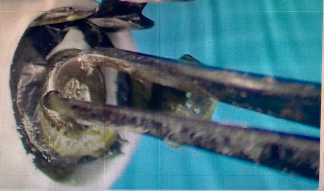 이런 모양 핀셋이나 포셉 이름 아시는분?????의 0번 째 이미지