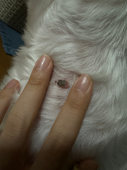 지방종을 긁어서 딱지가 생긴걸까요?의 1번 째 이미지