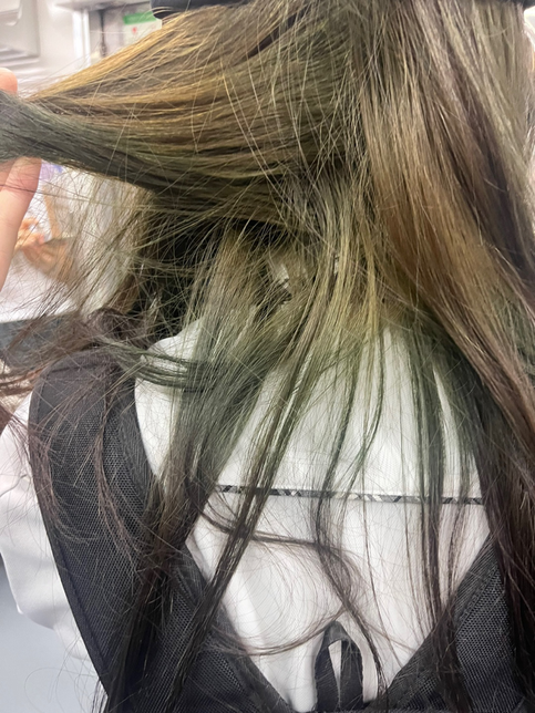 염색 동의서 작성했는데 환불 가능할까요?의 1번 째 이미지