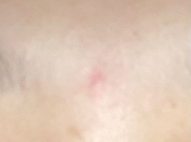 이마에 뭐가 났어요 이게 뭔가요?의 0번 째 이미지