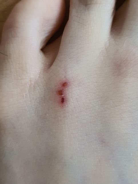 이 부위에 마일드원크림을 발라도 되나요?의 0번 째 이미지