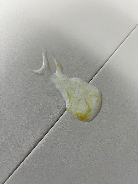 6개월 아기 토를 했는데 노란토가 나오네요 좀 알려주세요의 0번 째 이미지