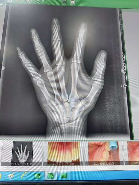 중3 남자 키 관련 질문 입니다. 진지하게 답변해주시면 감사하겠습니다.의 0번 째 이미지