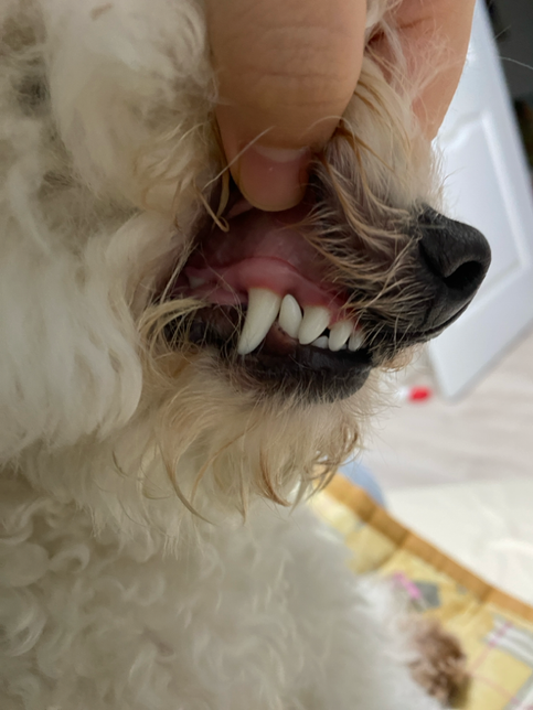 양치하다 피났는데 잇몸이랑 이빨 괜찮나요의 0번 째 이미지