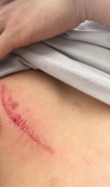 현장 타박상 사고 보상및 처리 방법 제가 해야되는 것들의 2번 째 이미지