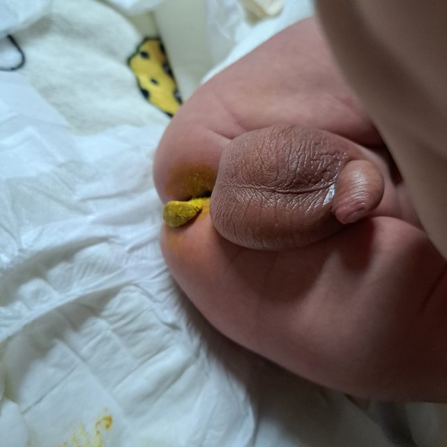 30일 안 된 아기 대변 정상인가요? 사진 주의의 0번 째 이미지