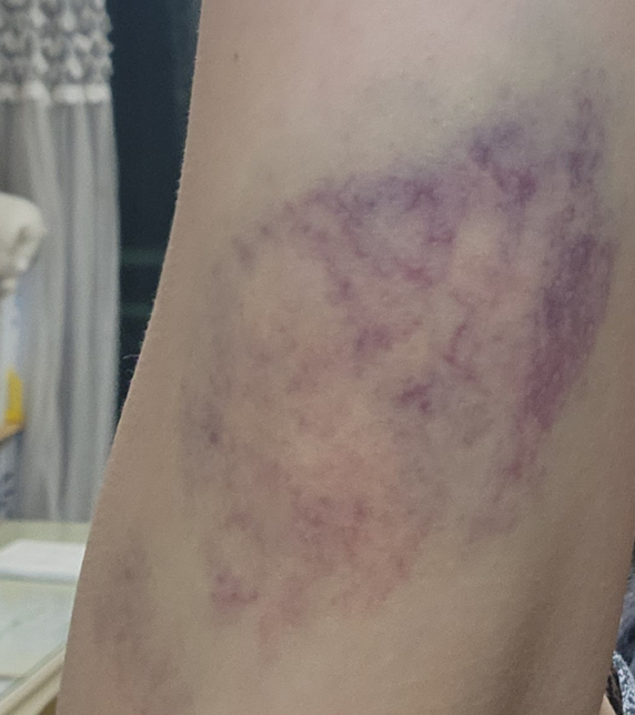 강간죄 성립 여부 판단부탁드립니다의 2번 째 이미지