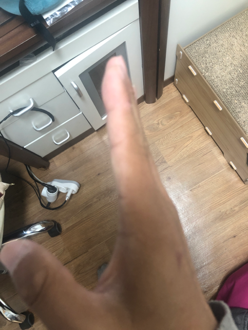 요즘 햇빛때문에 손이 탔습니다 관리방법 궁금합니다..의 0번 째 이미지