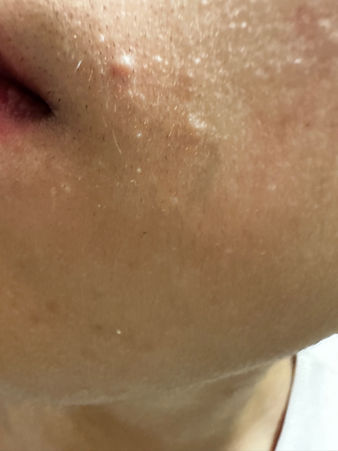 얼굴에 난 이거 혹시 사마귀인가요?의 3번 째 이미지
