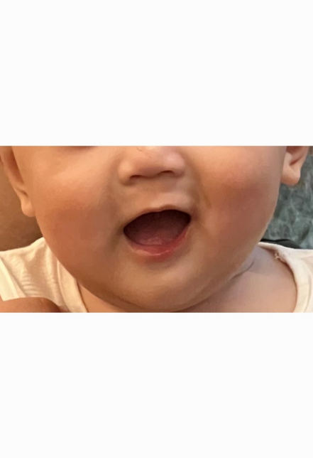 아기가 간혹 웃을때 입모양이 삐뚤어요의 0번 째 이미지