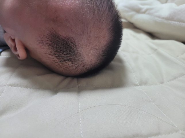 100일된아기 머리카락이 자라는길이가달라요의 0번 째 이미지