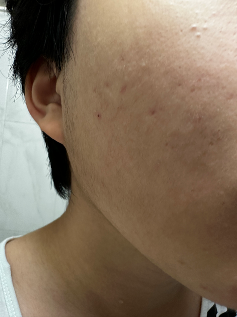 얼굴에 난 이거 혹시 사마귀인가요?의 0번 째 이미지