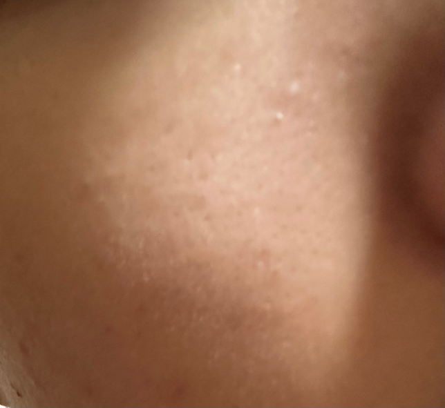 얼굴에 난 이거 혹시 사마귀인가요?의 1번 째 이미지