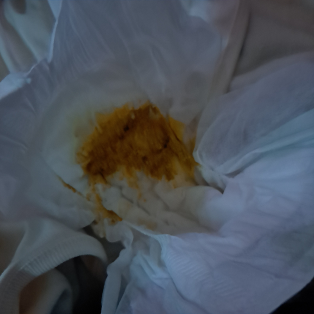 30일 안 된 아기 대변 정상인가요? 사진 주의의 1번 째 이미지