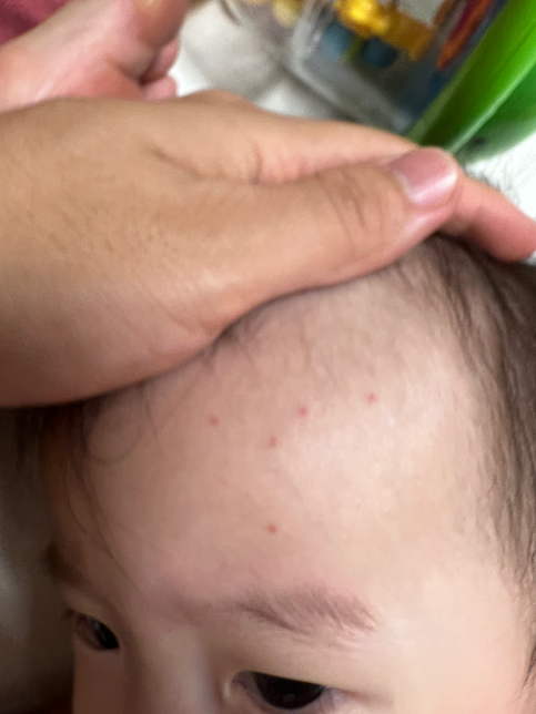 돌아기 빨간 반점 뭘까요? 얼굴쪽에만 조금 납니다의 1번 째 이미지