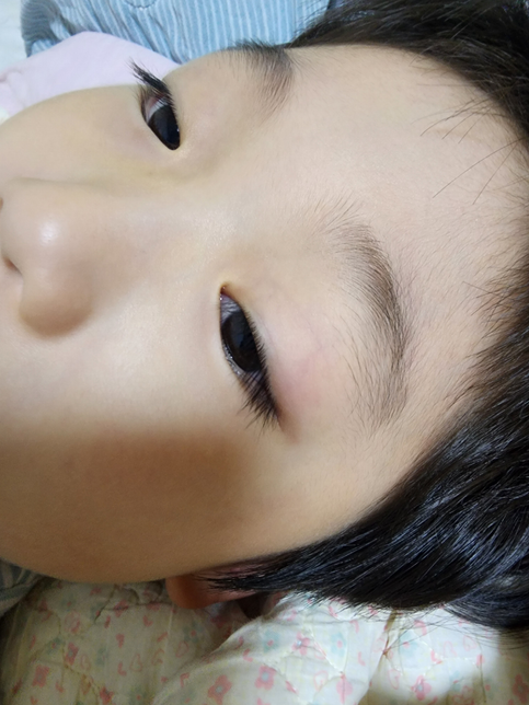 이 안약개봉한지 한달 넘었는데 넣어도 될까요?의 0번 째 이미지