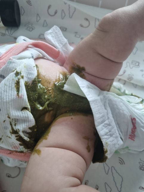 똥이 초록색에 설사가 심해요 왜이러는걸까요?의 1번 째 이미지