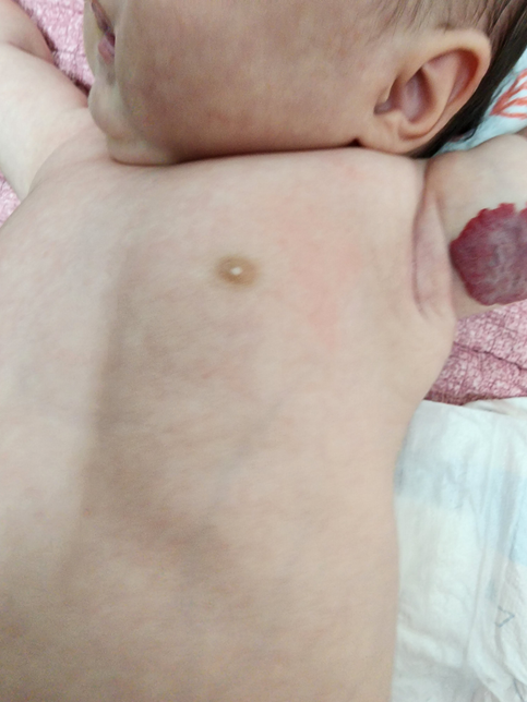 60일된딸아이아빠인데 이거한번봐주세요의 0번 째 이미지